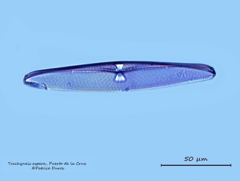 Diatomée Marine Récente : Trachyneis aspera #64853