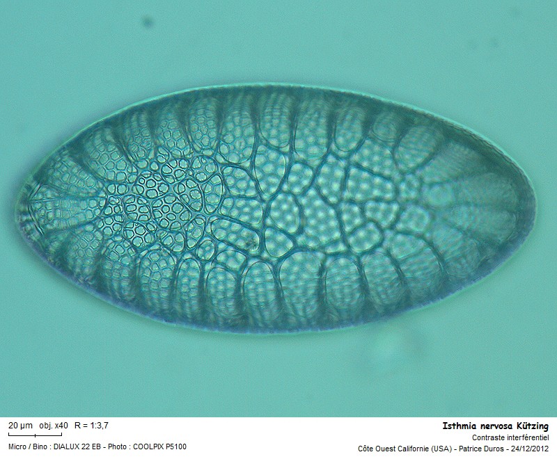 Diatomée marine de Californie : Isthmia nervosa Kützing #29294