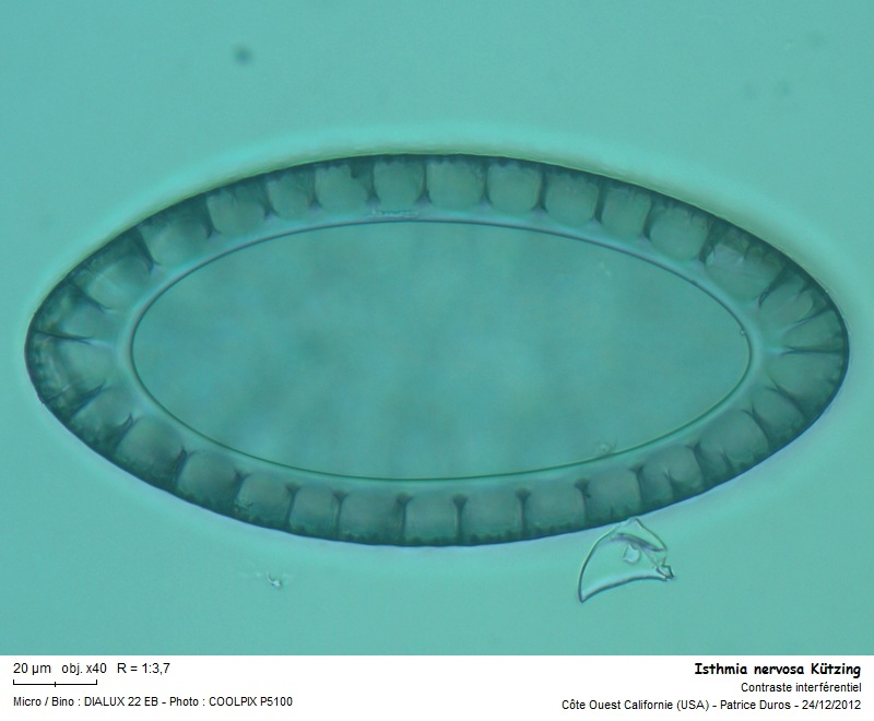 Diatomée marine de Californie : Isthmia nervosa Kützing #29295