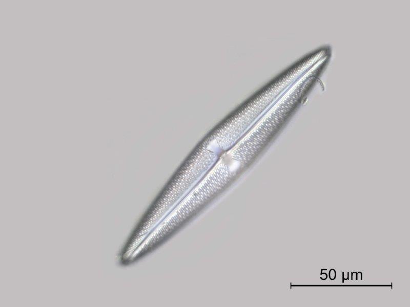 Diatomée marine actuelle de Teneriffe : Trachyneis aspera #53823