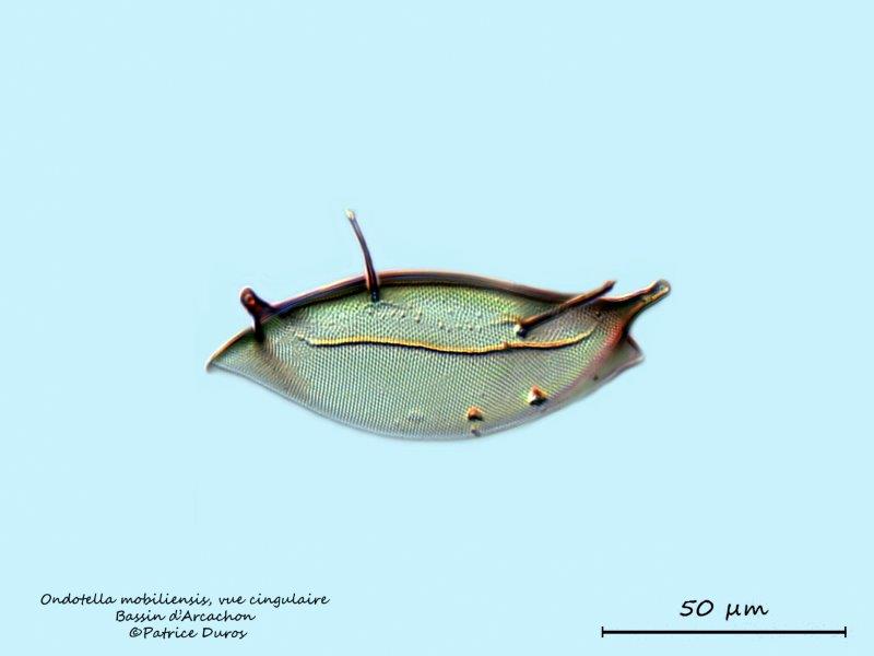 Diatomée Marine Récente : Ondotella mobiliensis #64852