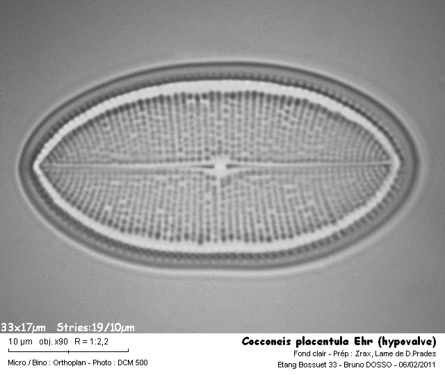 Diatomées d eau douce: inventaire d un étang. #32270