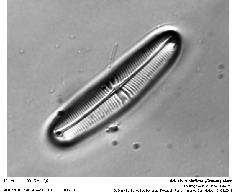 Dickieia subinflata (Grun.) Mann #47107