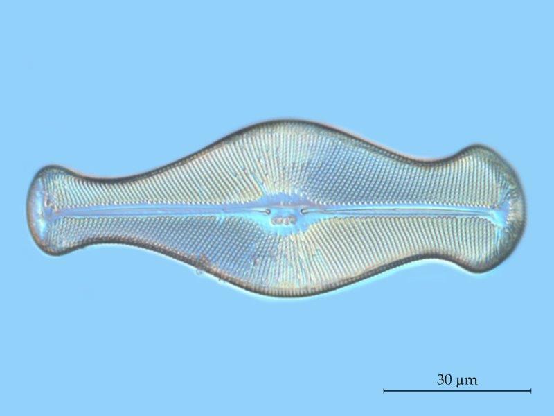 Didymosphenia geminata #57064