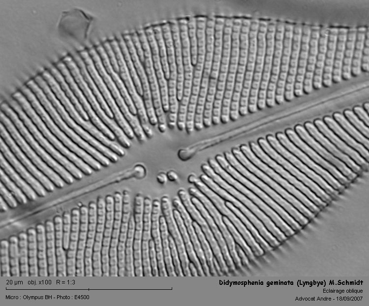 Didymosphenia geminata (Lyngbye) M.Schmidt #98
