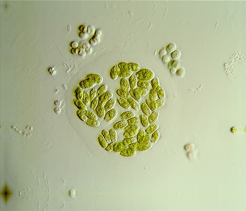 Dimorphococcus lunatus #22791