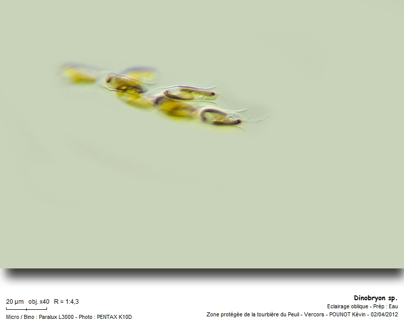Dinobryon sp. #26324