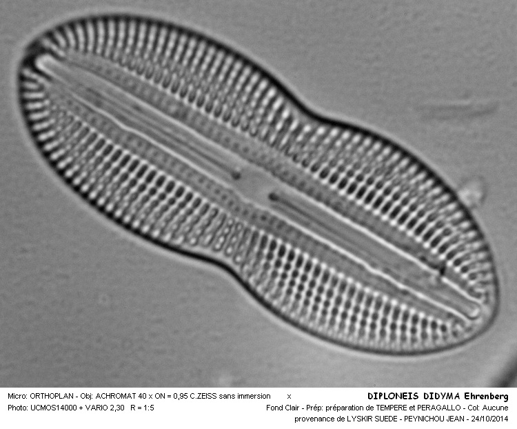 DIPLONEIS DIDYMA #39491