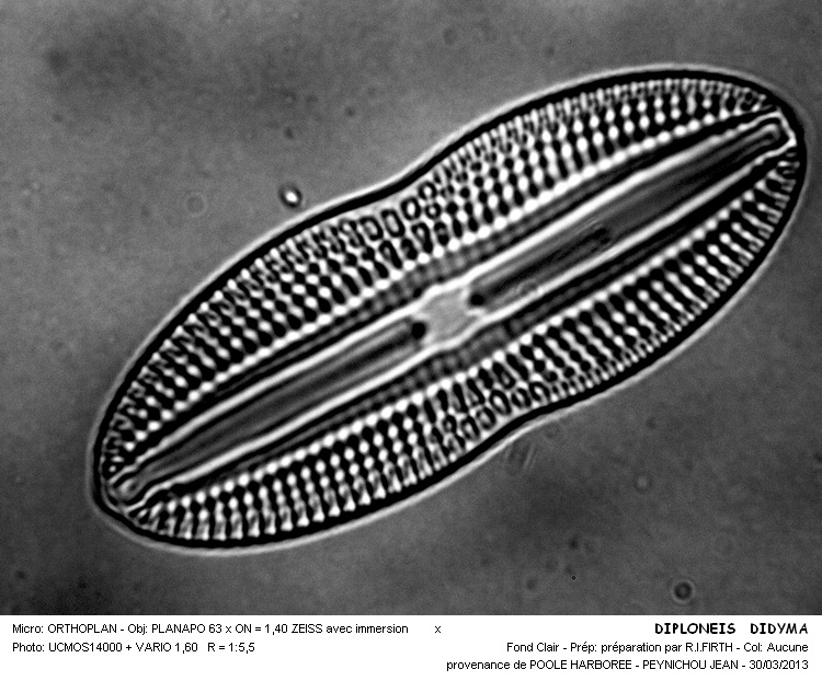 DIPLONEIS DIDYMA #30335