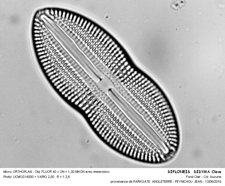 DIPLONEIS DIDYMA Cleve #45686