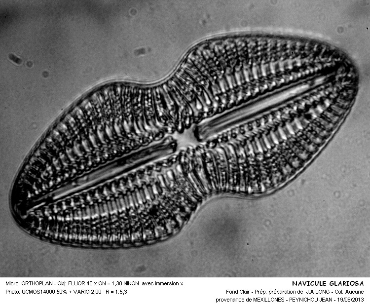 DIPLONEIS GLORIOSA #33372