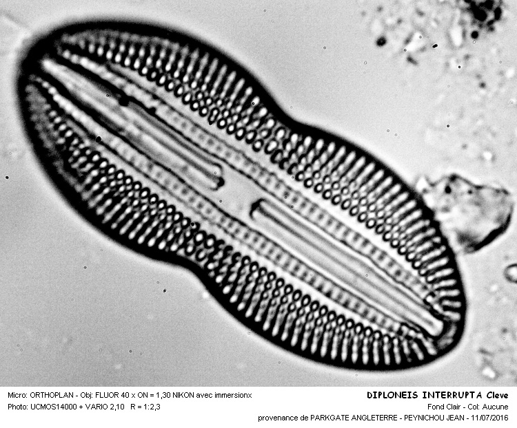 DIPLONEIS INTERRUPTA Cleve #46047