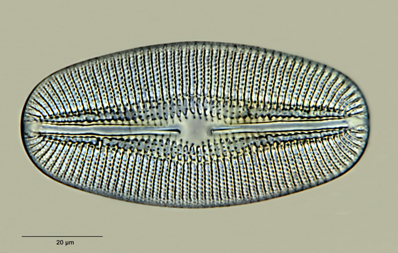 Diploneis subovalis var. argentina Frenguelli #26237