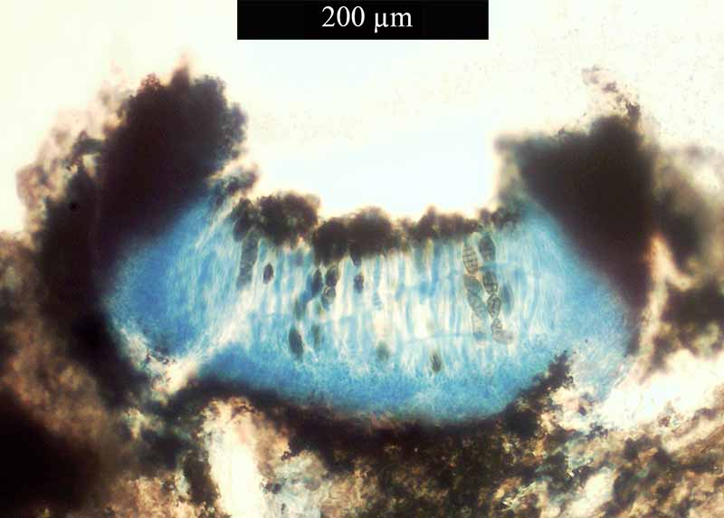 Diploschistes muscorum #49571