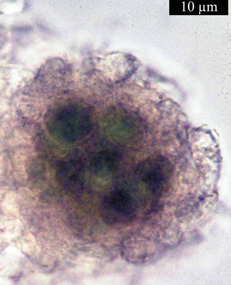 Diploschistes muscorum #49575
