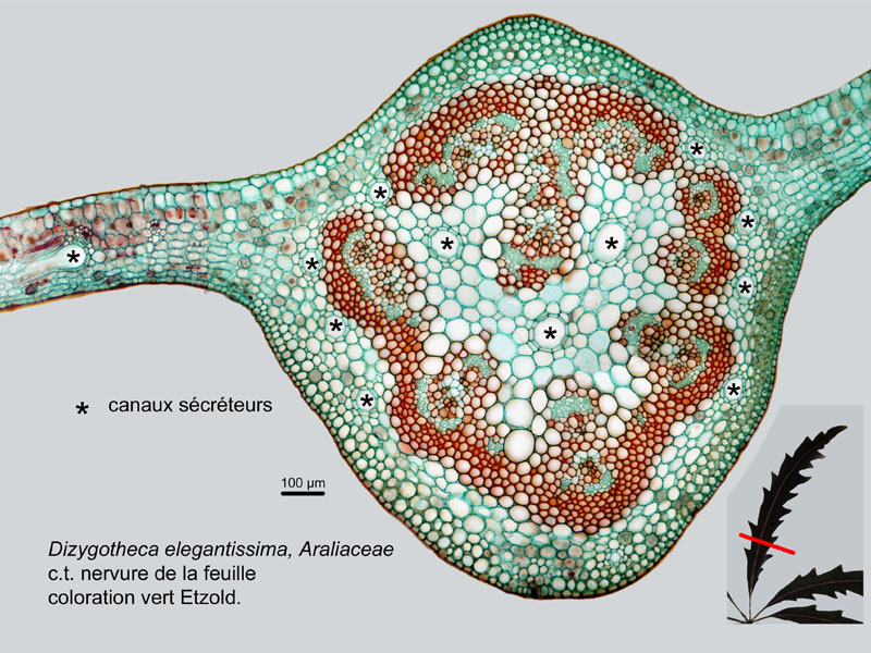 Dizygotheca elegantissima, histologie #18487