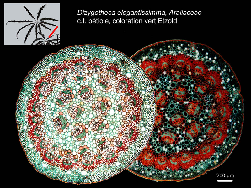 Dizygotheca elegantissima, histologie #18484