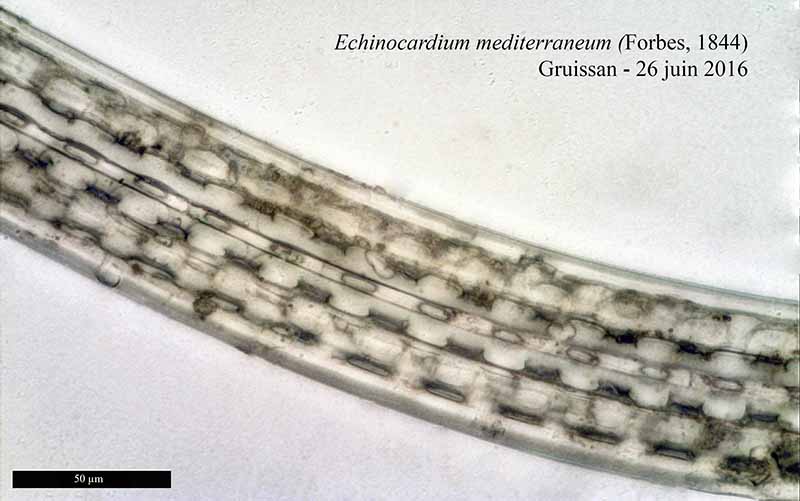 Echinocardium mediterraneum (Forbes, 1844) #46011