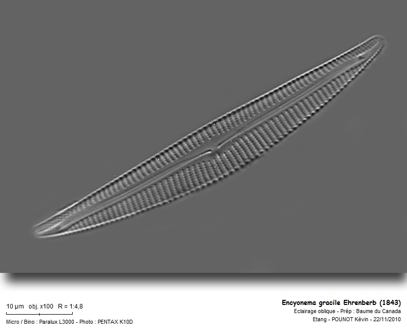 Encyonema gracile Ehrenberb (1843) #19207