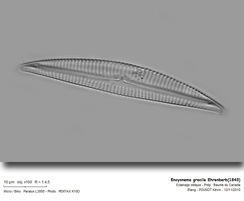 Encyonema gracile Ehrenberb (1843) #19031