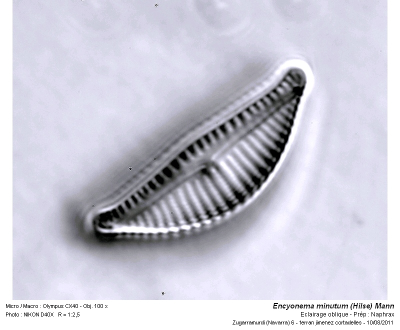 Encyonema minutum (Hilse in Rabenhorst) Mann #25861