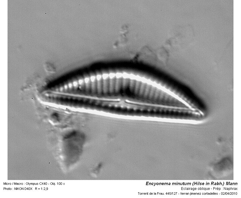 Encyonema minutum (Hilse in Rabh.) Mann #15606