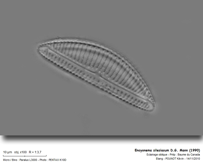 Encyonema silesiacum (Bleisch) D.G. Mann (1990) #19057