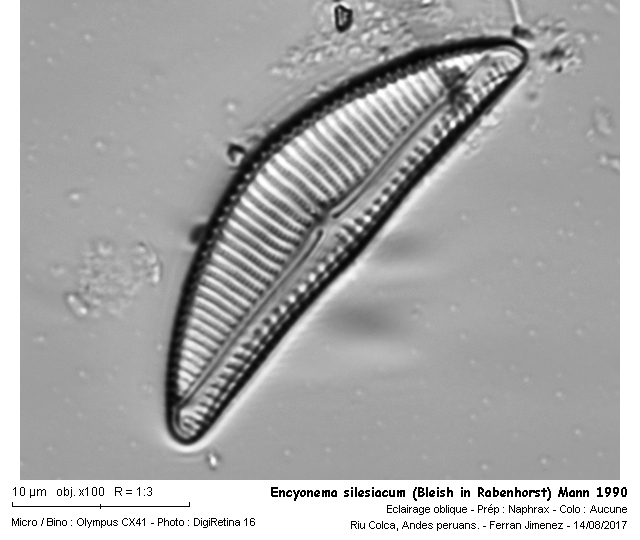 Encyonema silesiacum (Bleish in Rabenhorst) Mann 1990 #53364