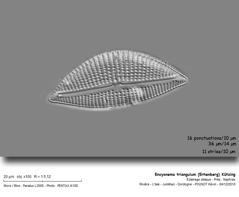 Encyonema triangulum (Erhenberg) Kützing #19463