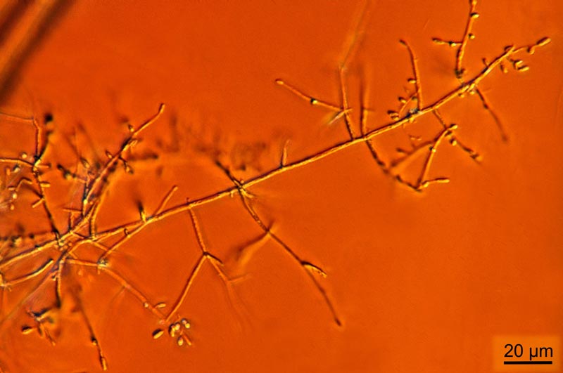 Engyodontium aranearum #36692