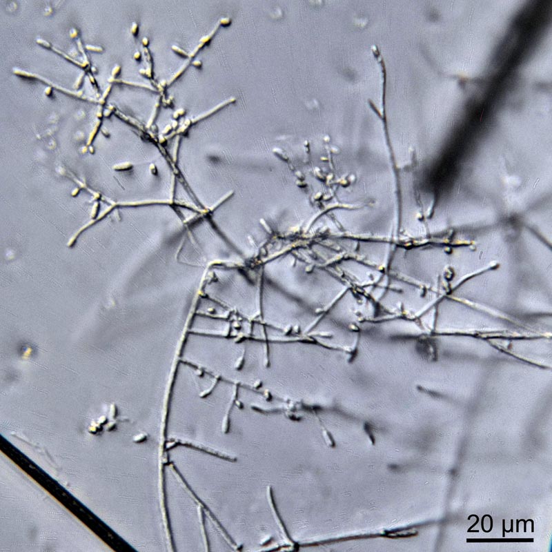 Engyodontium aranearum #36695