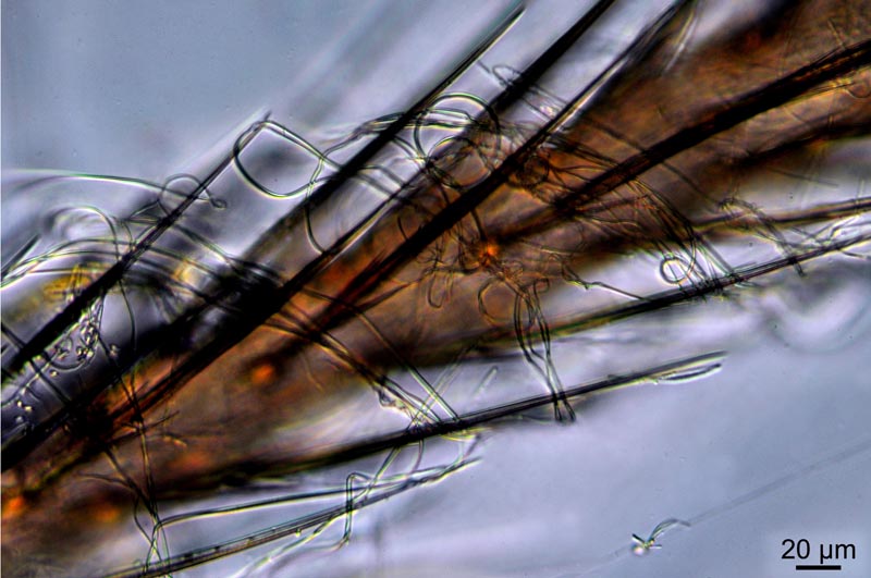 Engyodontium aranearum #36691