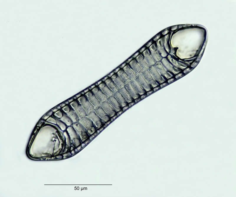 Entopyla australis var. gigantea (Greville) Fricke #18235