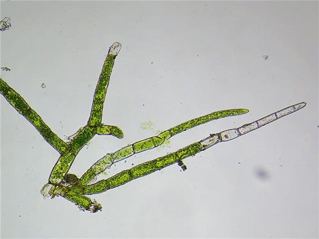 Ephemerum minutissimum Lindb. (E. serratum (Hedw.) Hampe) #61731