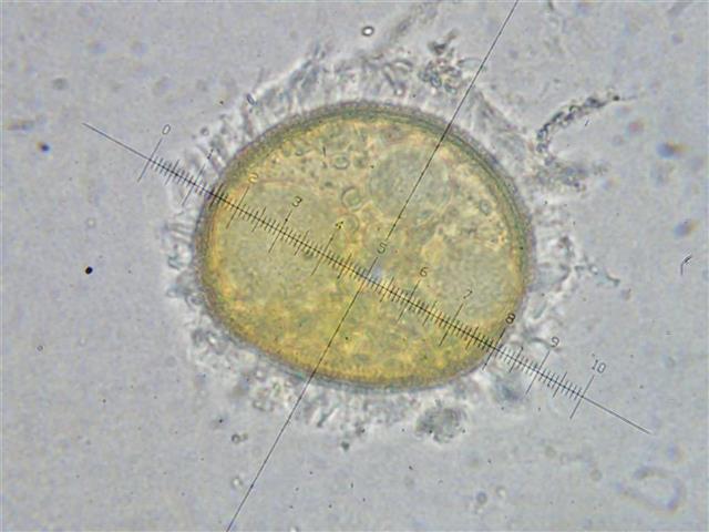 Ephemerum minutissimum Lindb. (E. serratum (Hedw.) Hampe) #61734