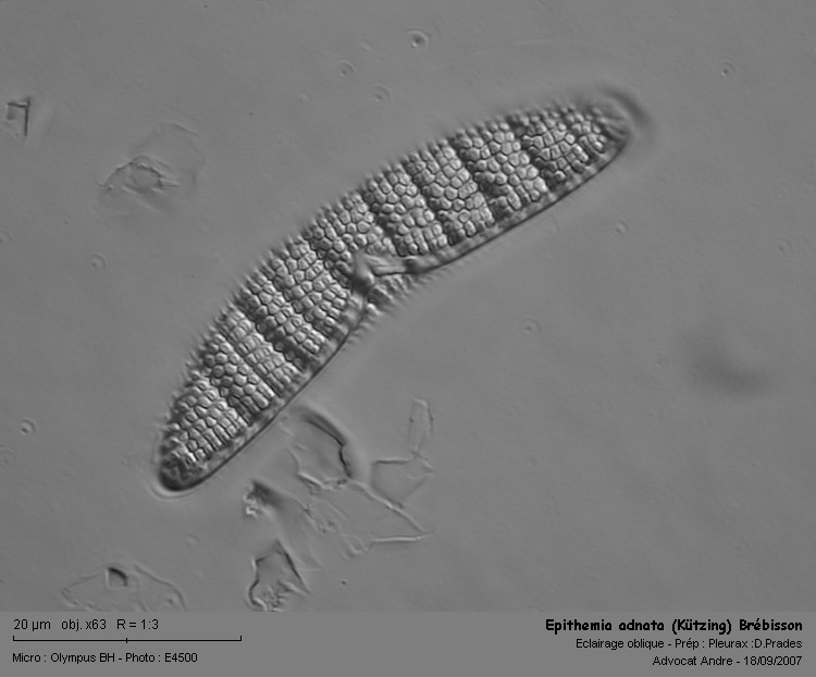 Epithemia adnata (Kützing) Bréb.1838 #129