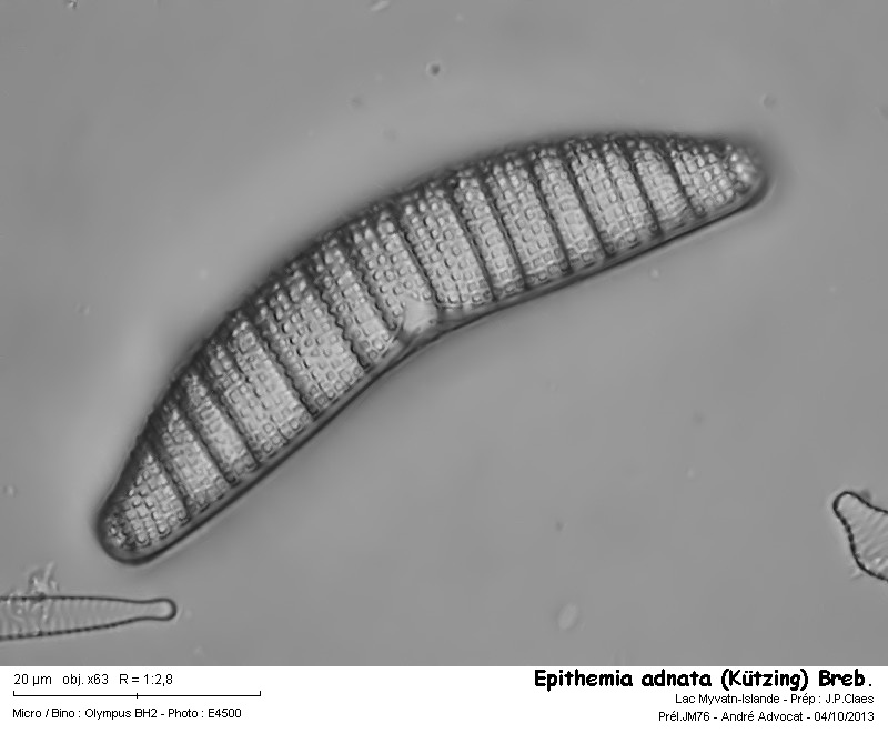 Epithemia adnata (Kützing) Bréb. #34134