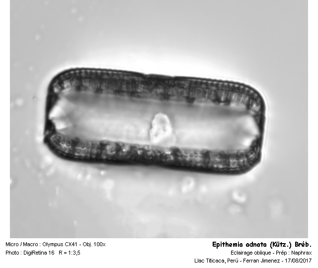 Epithemia adnata (Kützing) Brébisson #54261