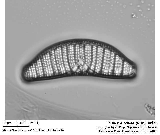 Epithemia adnata (Kützing) Brébisson #54259
