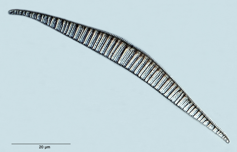 Epithemia gibberula var. perlonga #29916