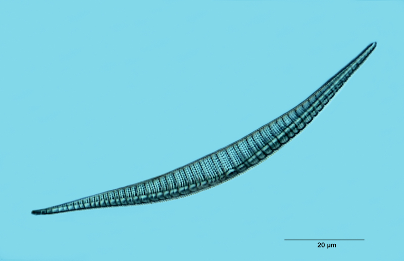 Epithemia gibberula var. perlonga #29917
