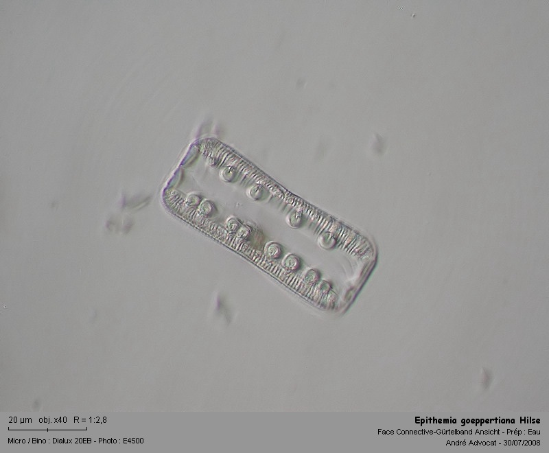 Epithemia goeppertiana Hilse #4915