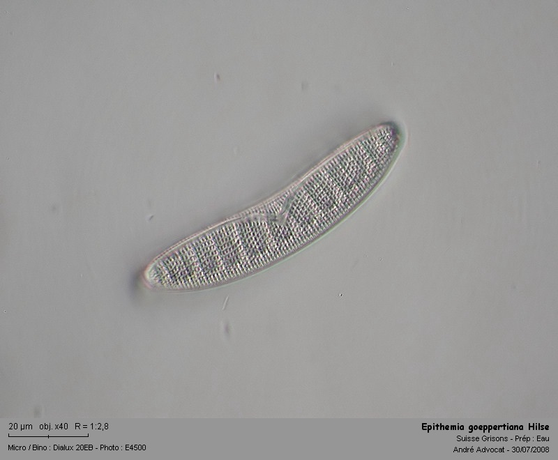 Epithemia goeppertiana Hilse #4916