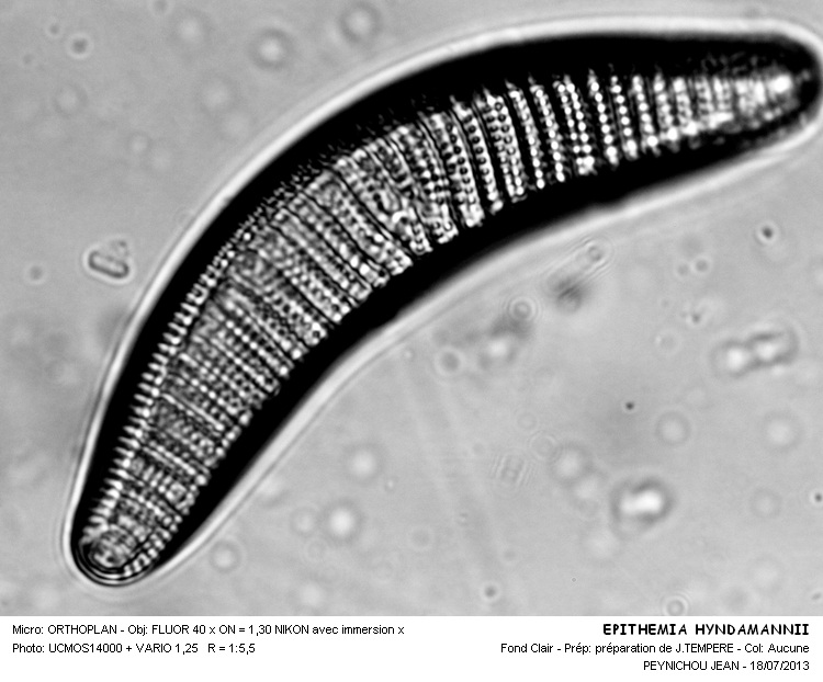 Epithemia hyndmannii W.Smith #32753
