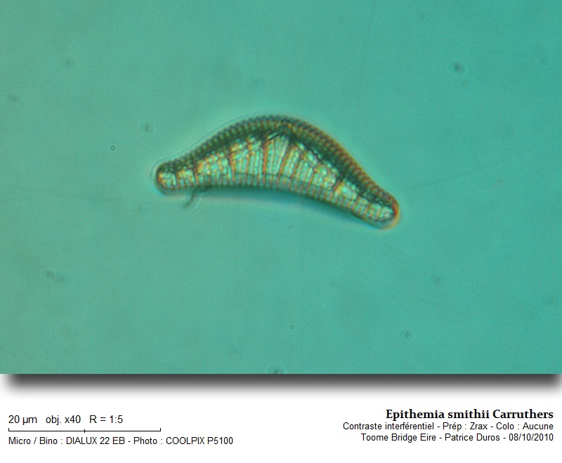 Epithemia smithii Carruthers #18770