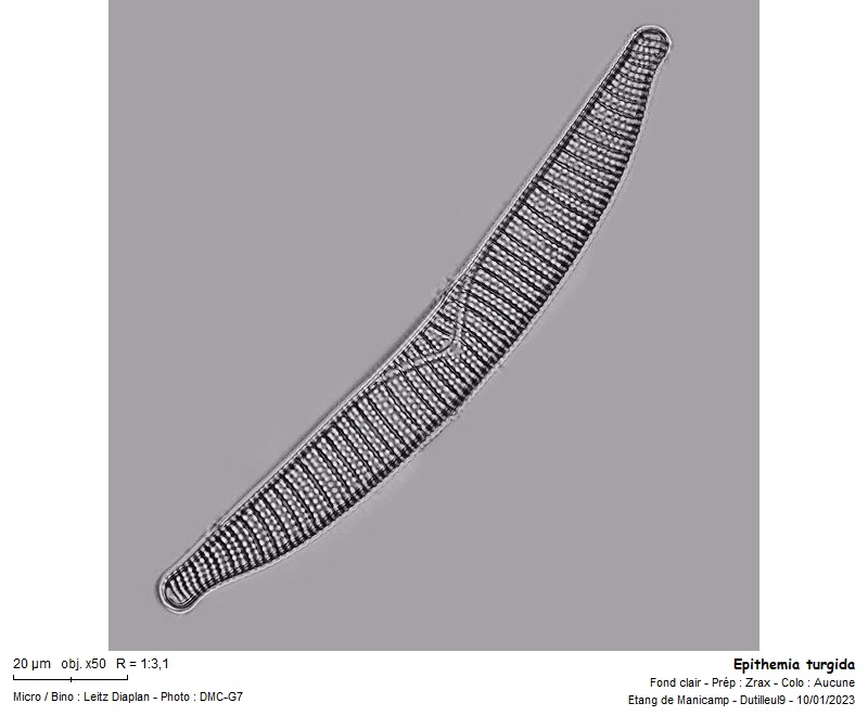 Epithemia turgida Ehrenberg #73368