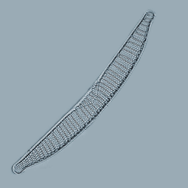 Epithemia turgida Ehrenberg #73367