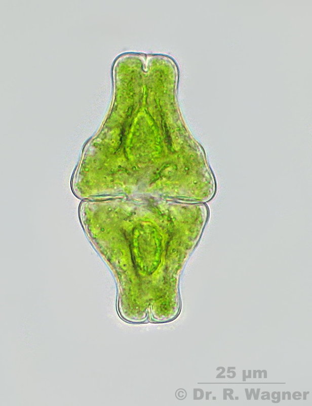Euastrum ansatum var. pyxidatum DELP #3525