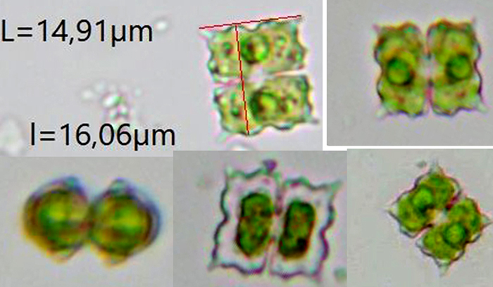 Euastrum biverrucosum #77093