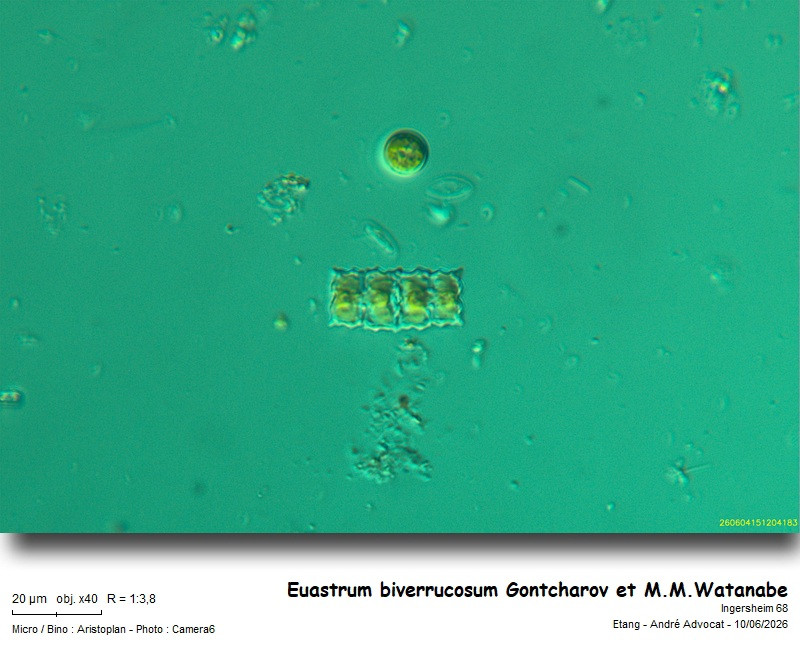 Euastrum biverrucosum Gontcharov & Watanabe #86258